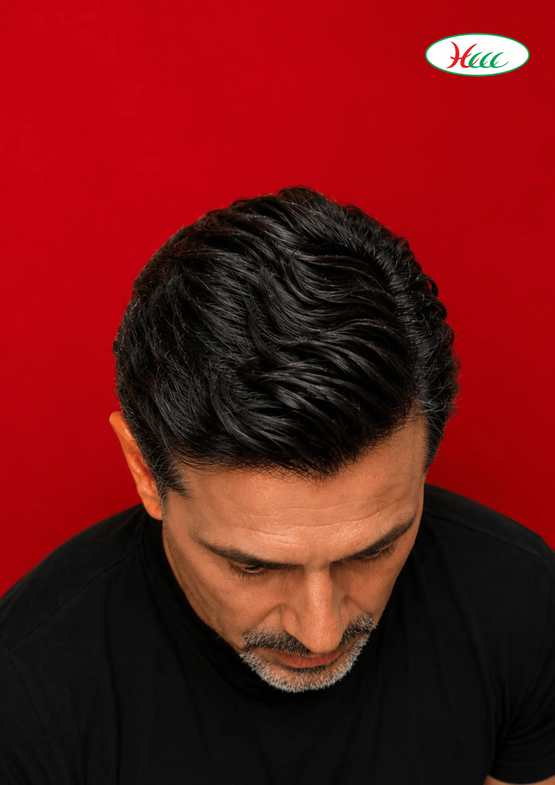 Men's Hair Extensions Result - Natural Full Hair After Treatment at HCCC Coimbatore